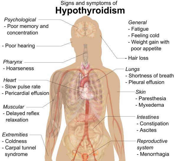17 best Thyroid Problems images on Pinterest