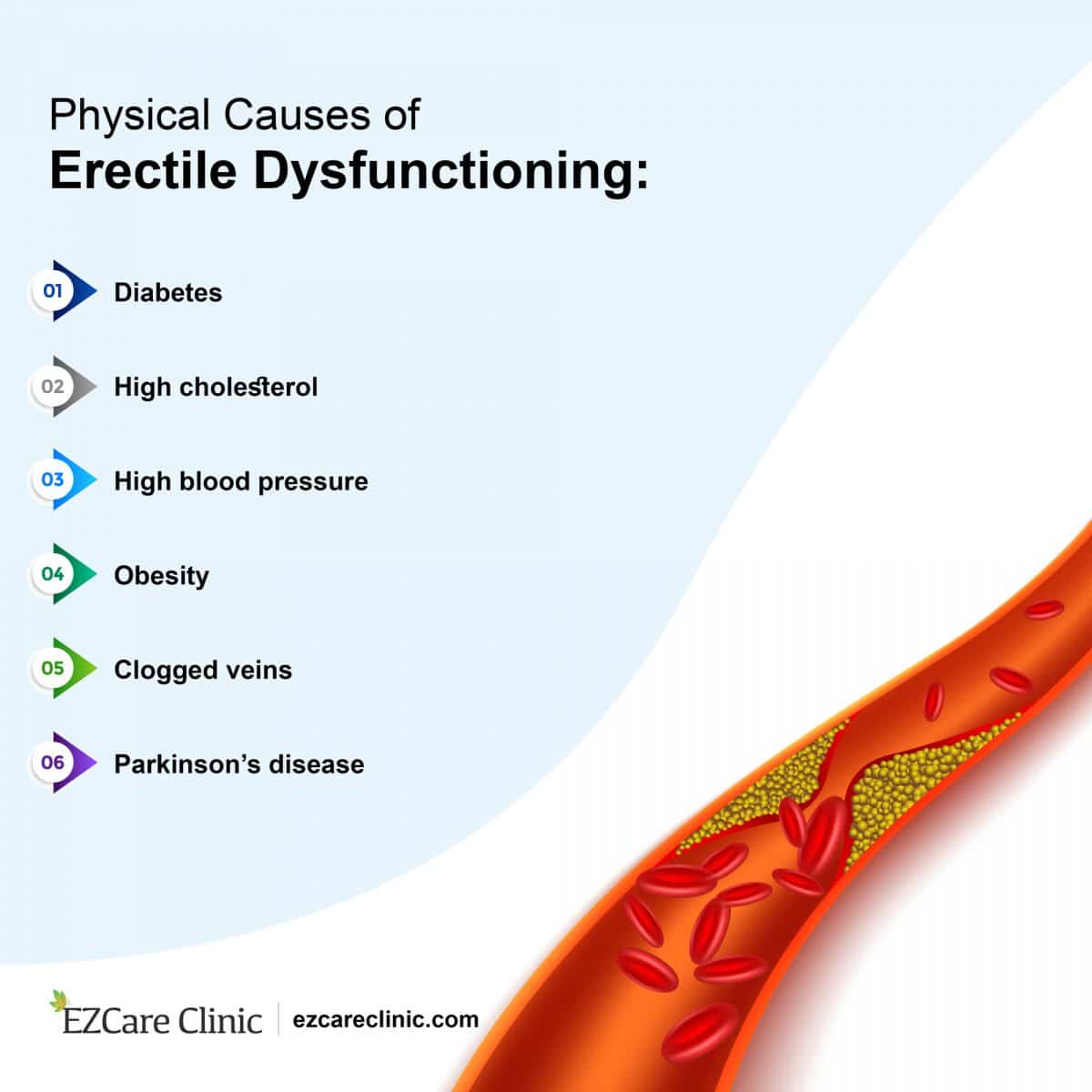 7 Common Causes of Erectile Dysfunction