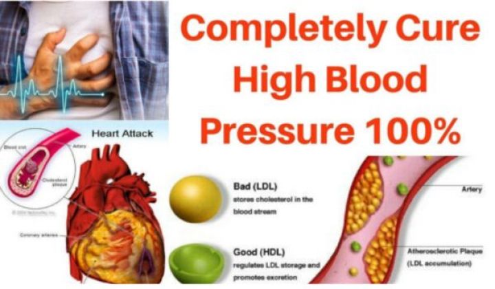 9 Instant Home Remedies for High Blood Pressure