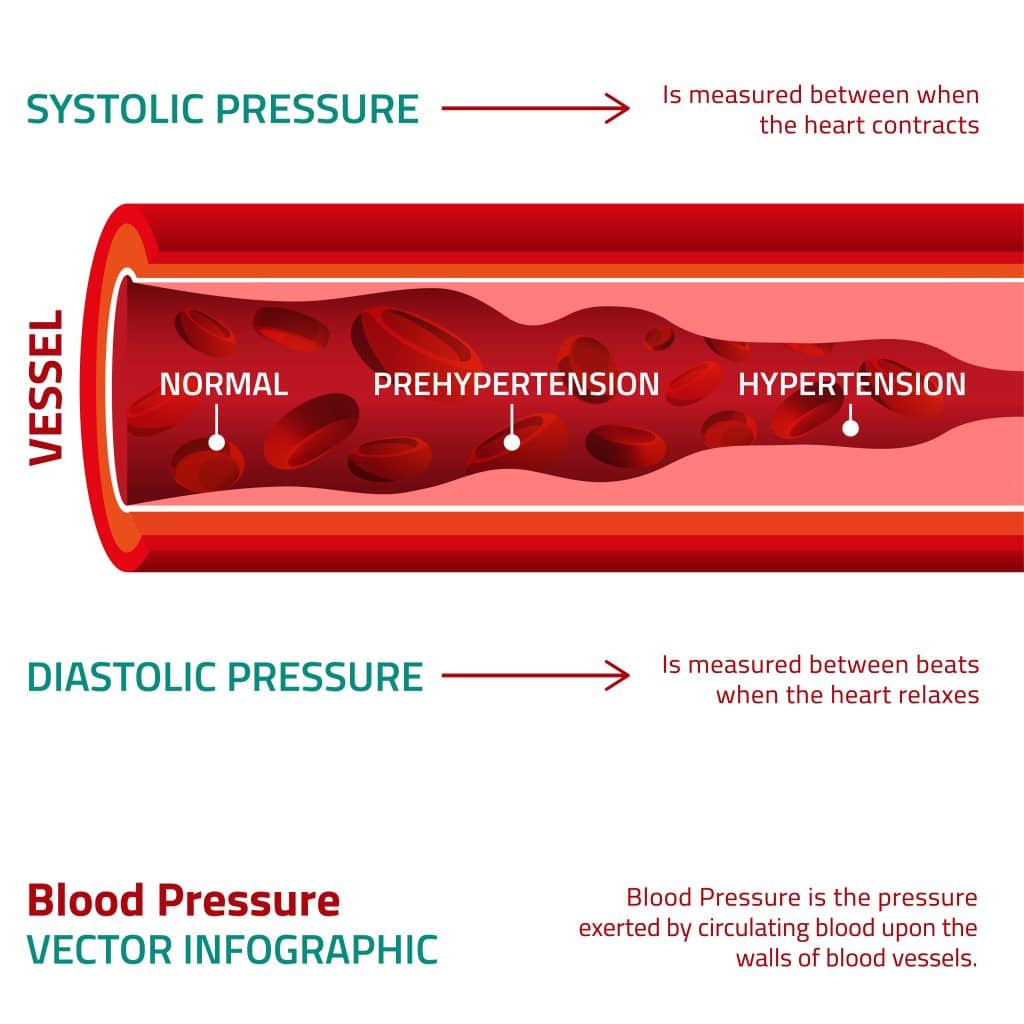 Blood Pressure and Exercise