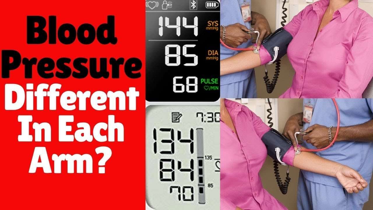 Blood Pressure Different In Each Arm? The Meaning ...