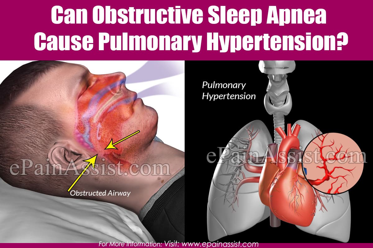Can Obstructive Sleep Apnea cause Pulmonary Hypertension?
