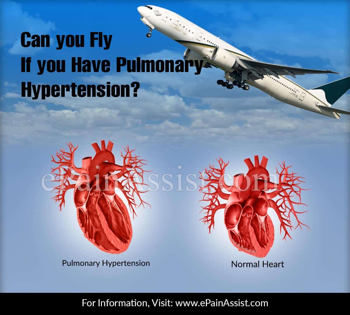 Can you Fly if you Have Pulmonary Hypertension?