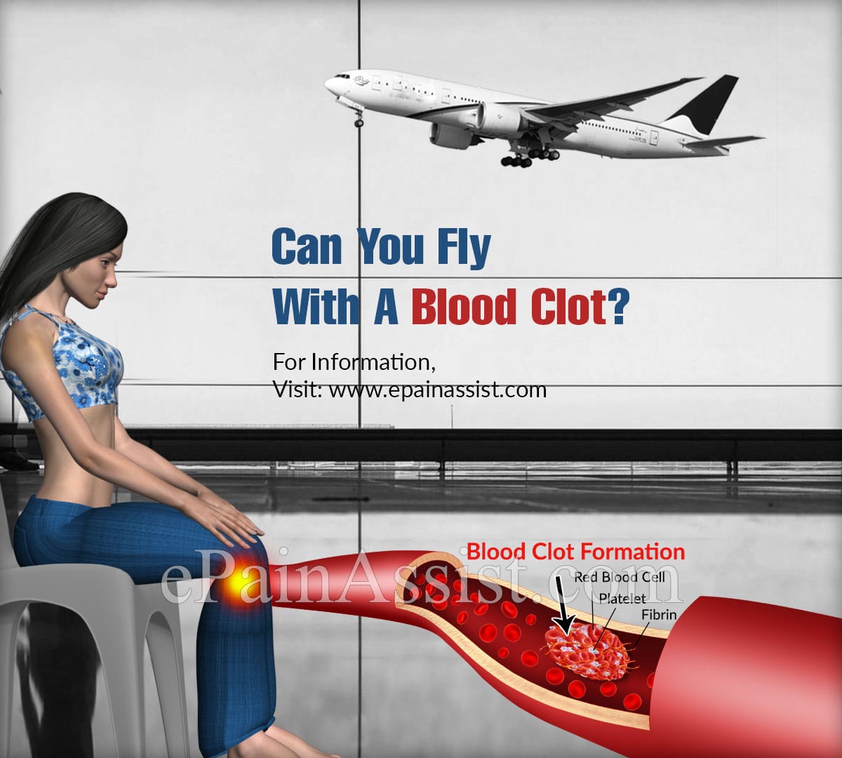 Can You Fly With A Blood Clot &  What are the Precautions to be Taken?