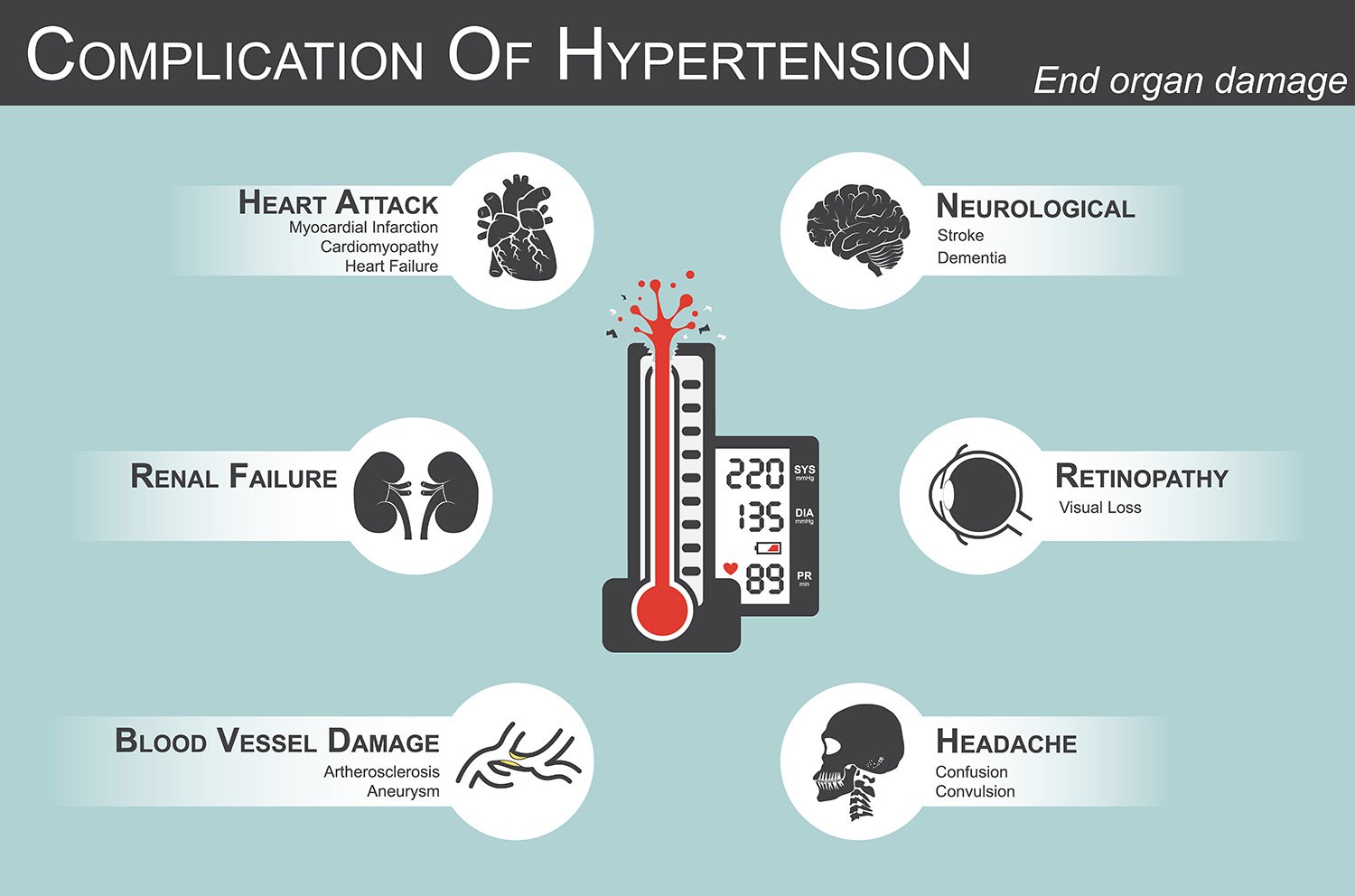 Cannabis and Hypertension