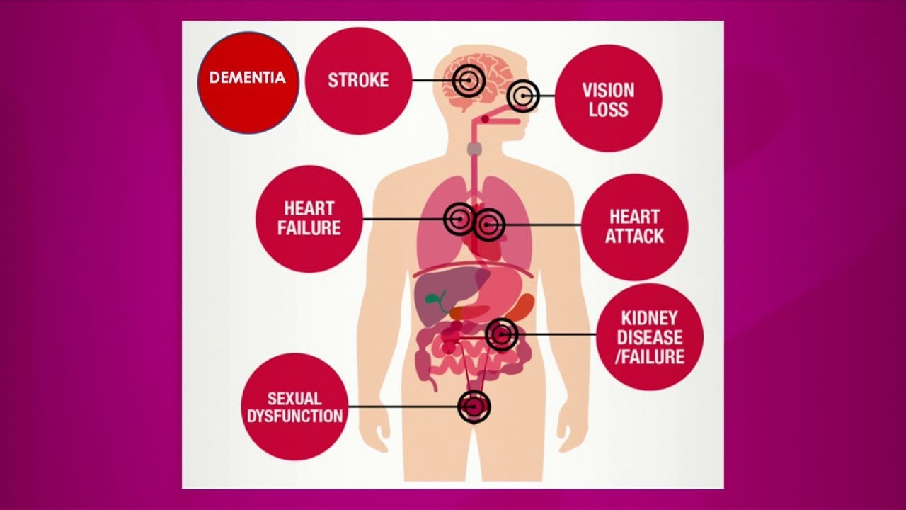 Causes of High Blood Pressure