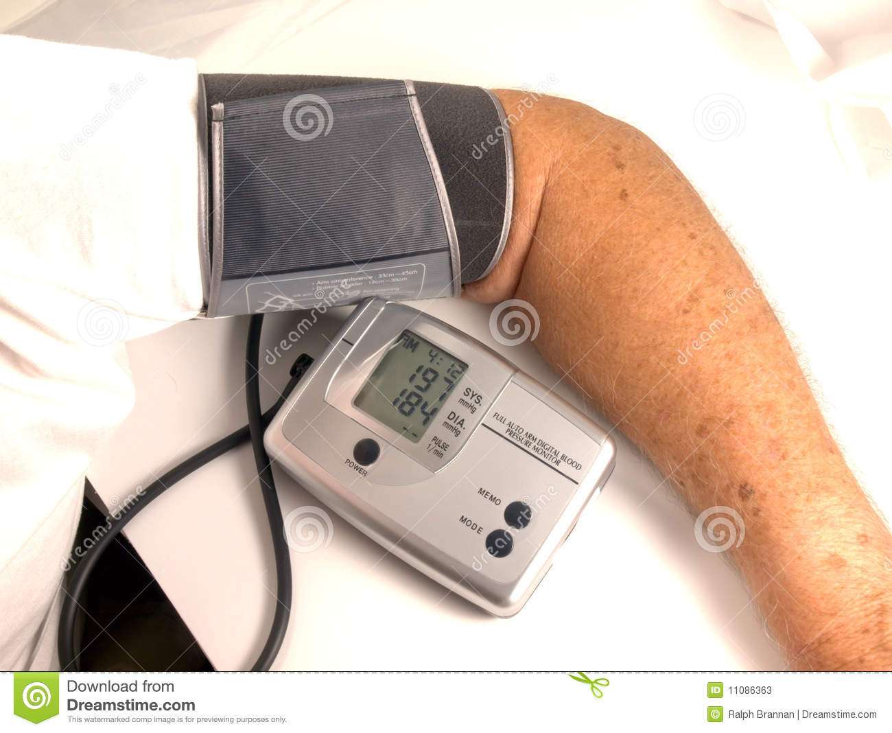 Extremely High Blood Pressure Stock Image