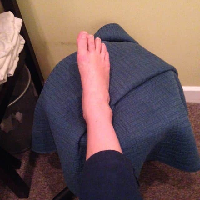 getting a foot rub for swollen ankle