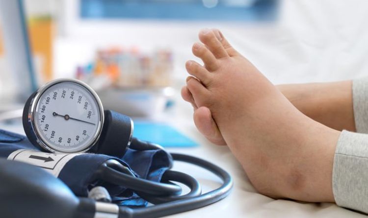 High blood pressure: Swollen ankles is oedema and means ...