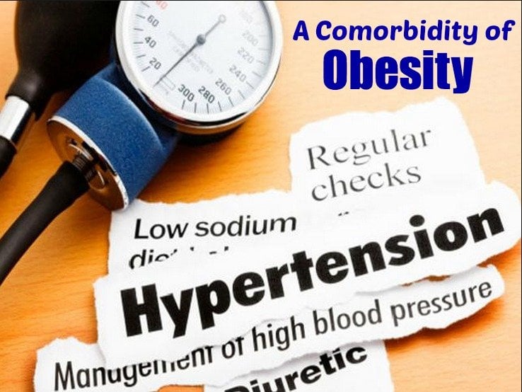 Hypertension â Comorbid Effect of Obesity