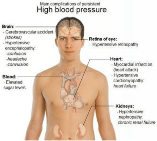 Ideal Cure...: hypertension