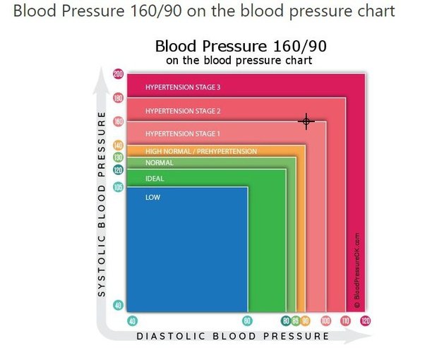 Is a blood pressure of 160/90 high?