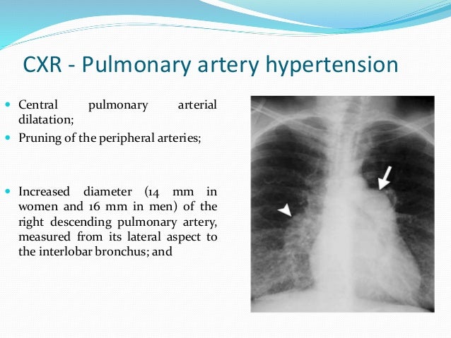 Pediatric pulmonary hypertension