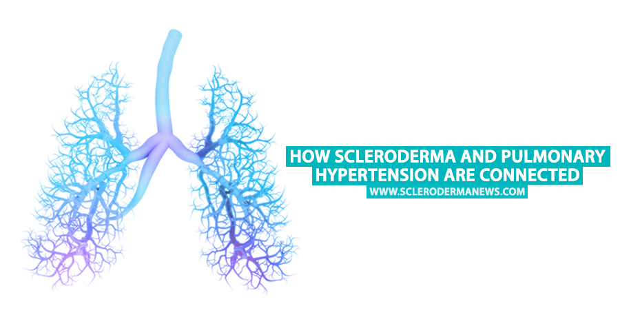 Pin on Scleroderma News