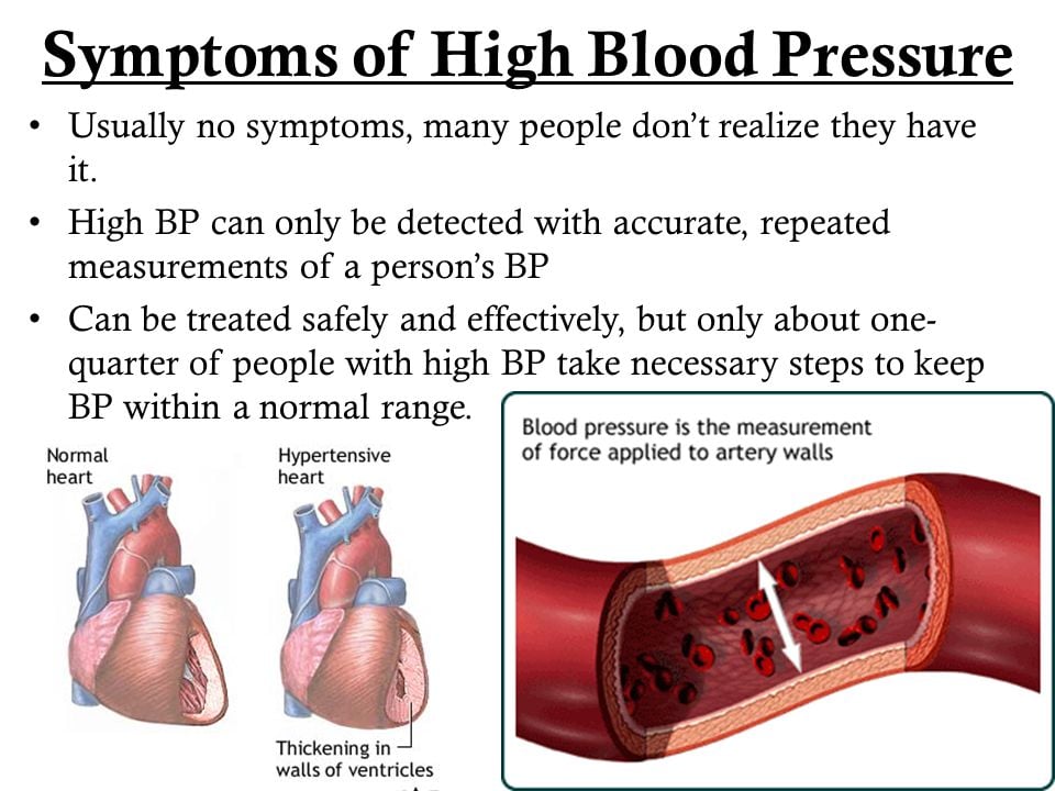 Signs & Symptoms of High Blood Pressure