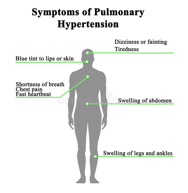 Symptoms Of Pulmonary Hypertension Stock Illustration ...