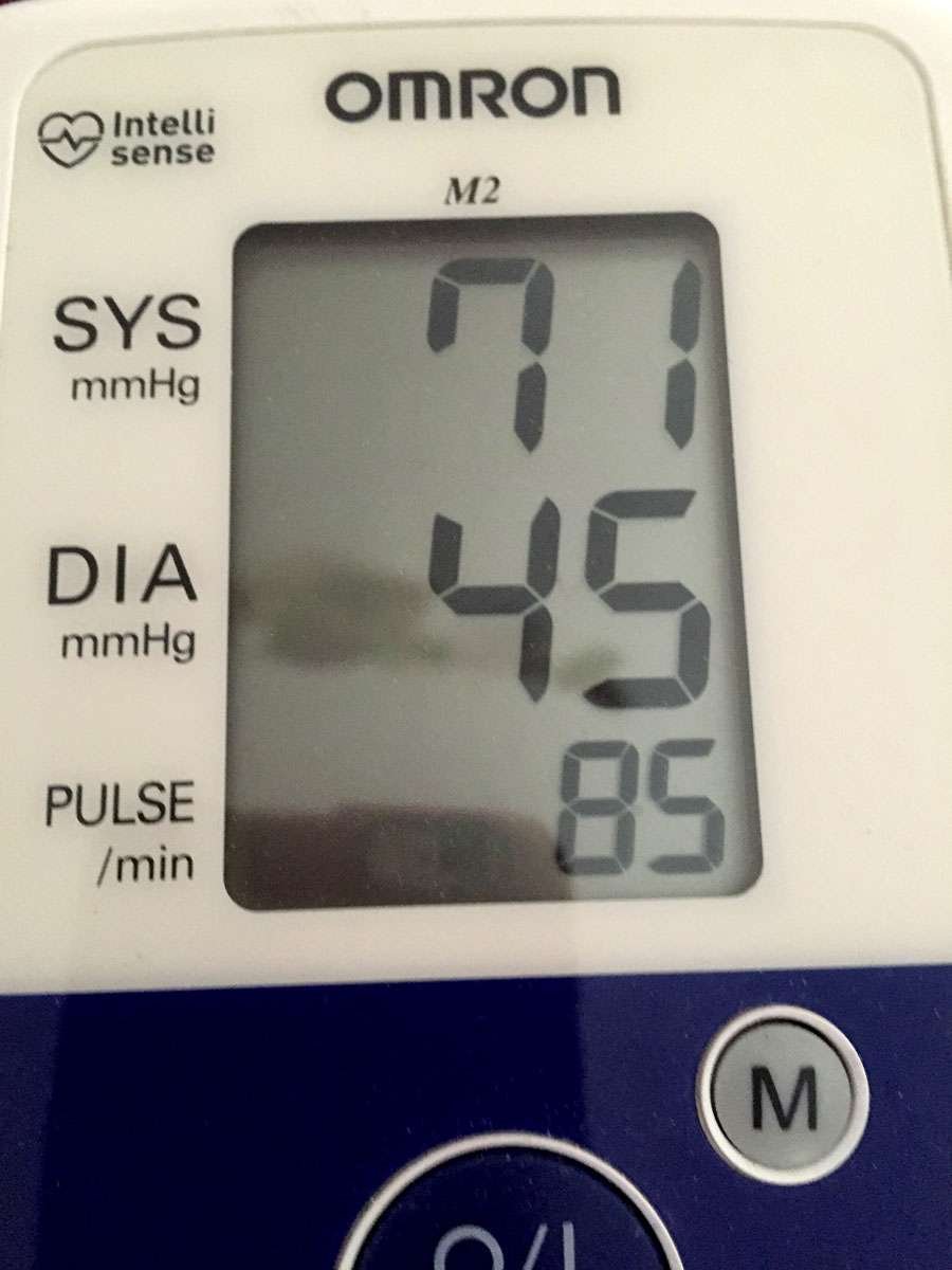 Very low blood pressure?!!