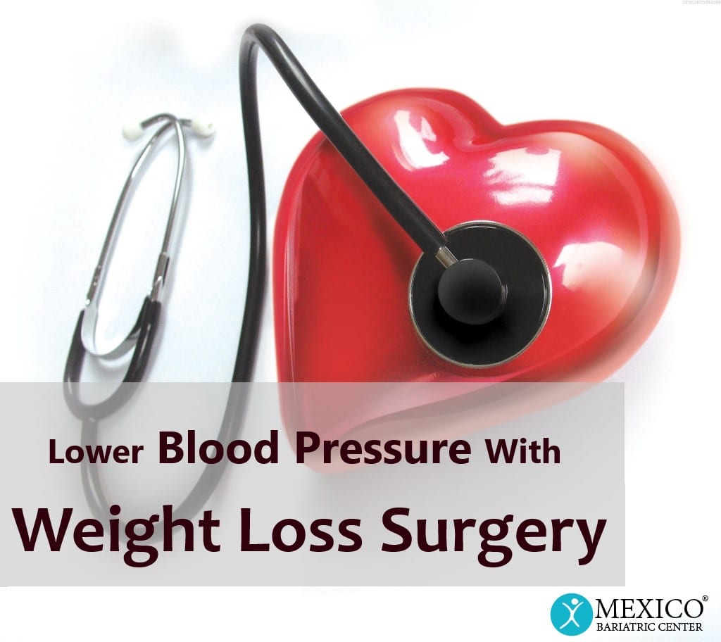 Weight Loss Surgery Helps Resolve High Blood Pressure (Hypertension)
